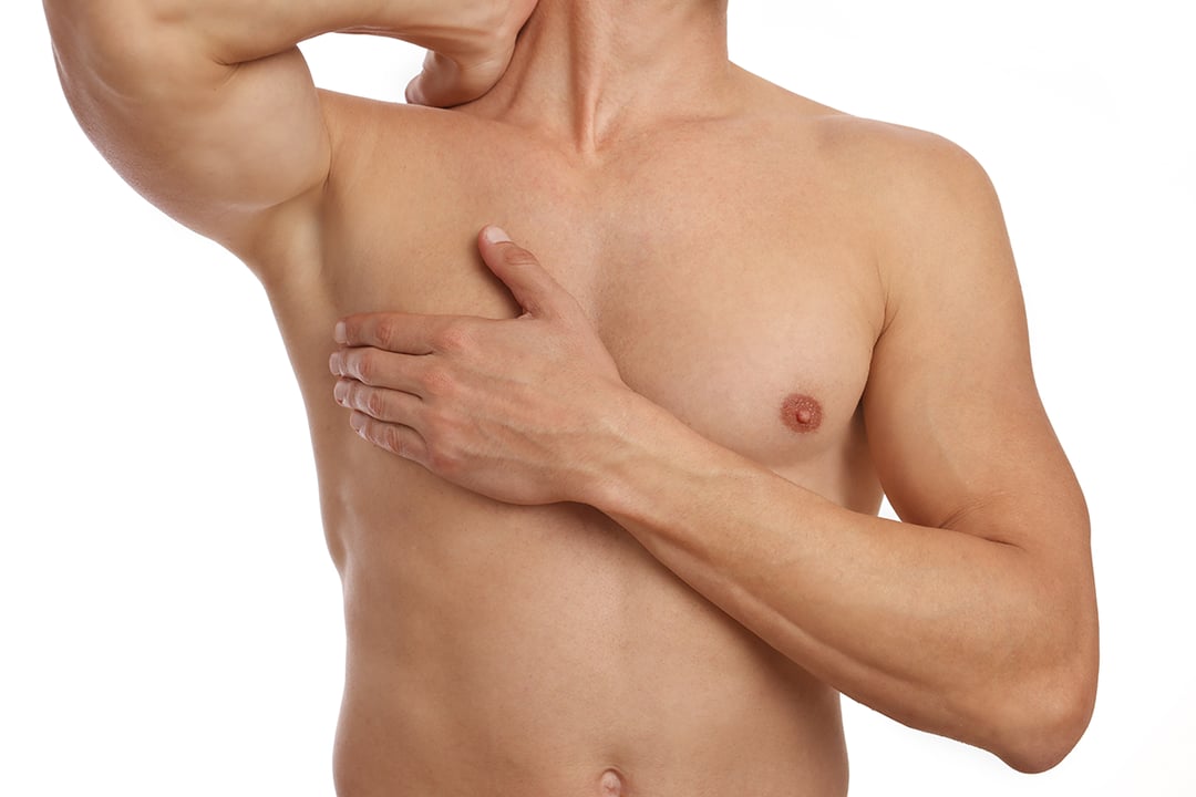 FAQs Gynecomastia: Male Breast Reduction Thousand Oaks