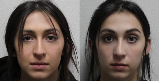 rhinoplasty before and after photos by kryger institute of plastic surgery in thousand oaks ca
